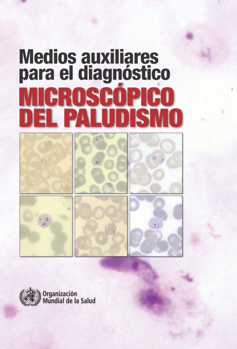 Medios auxiliares para el diagnóstico microscópico del paludismo