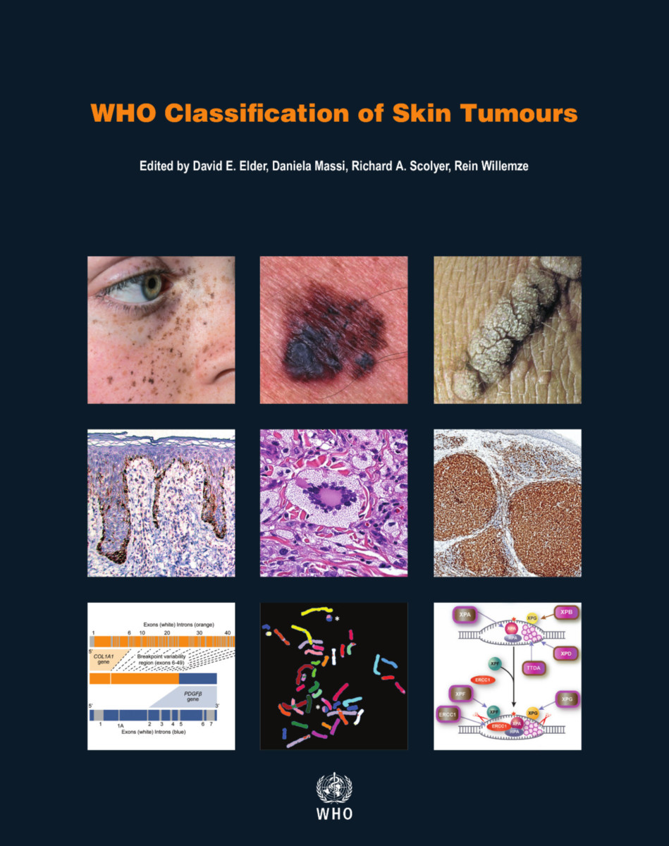 WHO Classification of Skin Tumours