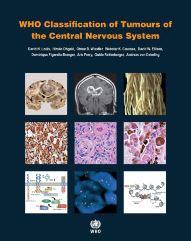 WHO Classification of Tumours of the Central Nervous System