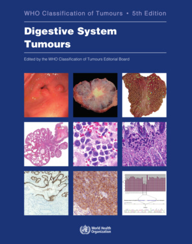 Digestive System Tumours