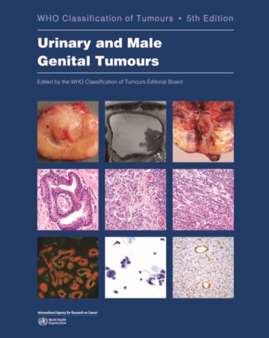 Urinary and Male Genital Tumours